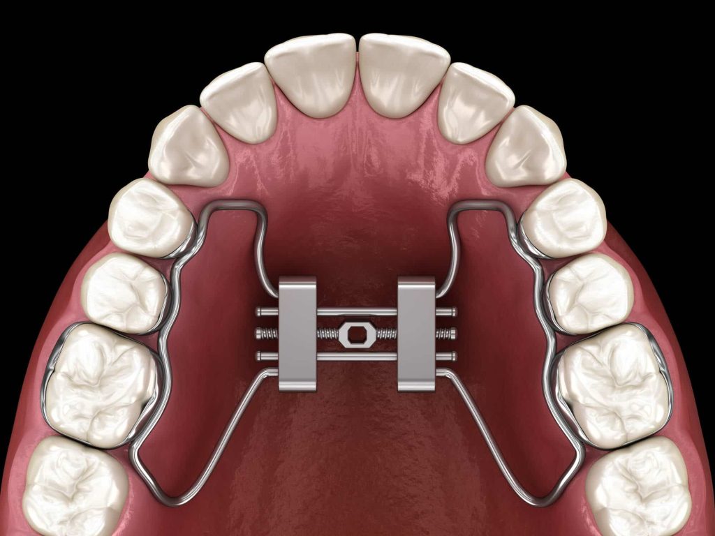 Tongue Tie Surgery Costs for Adults