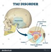 TMD Friction