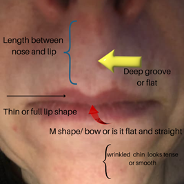 how common is a lip tie