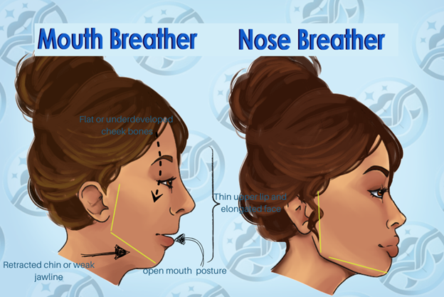 mouth breathing